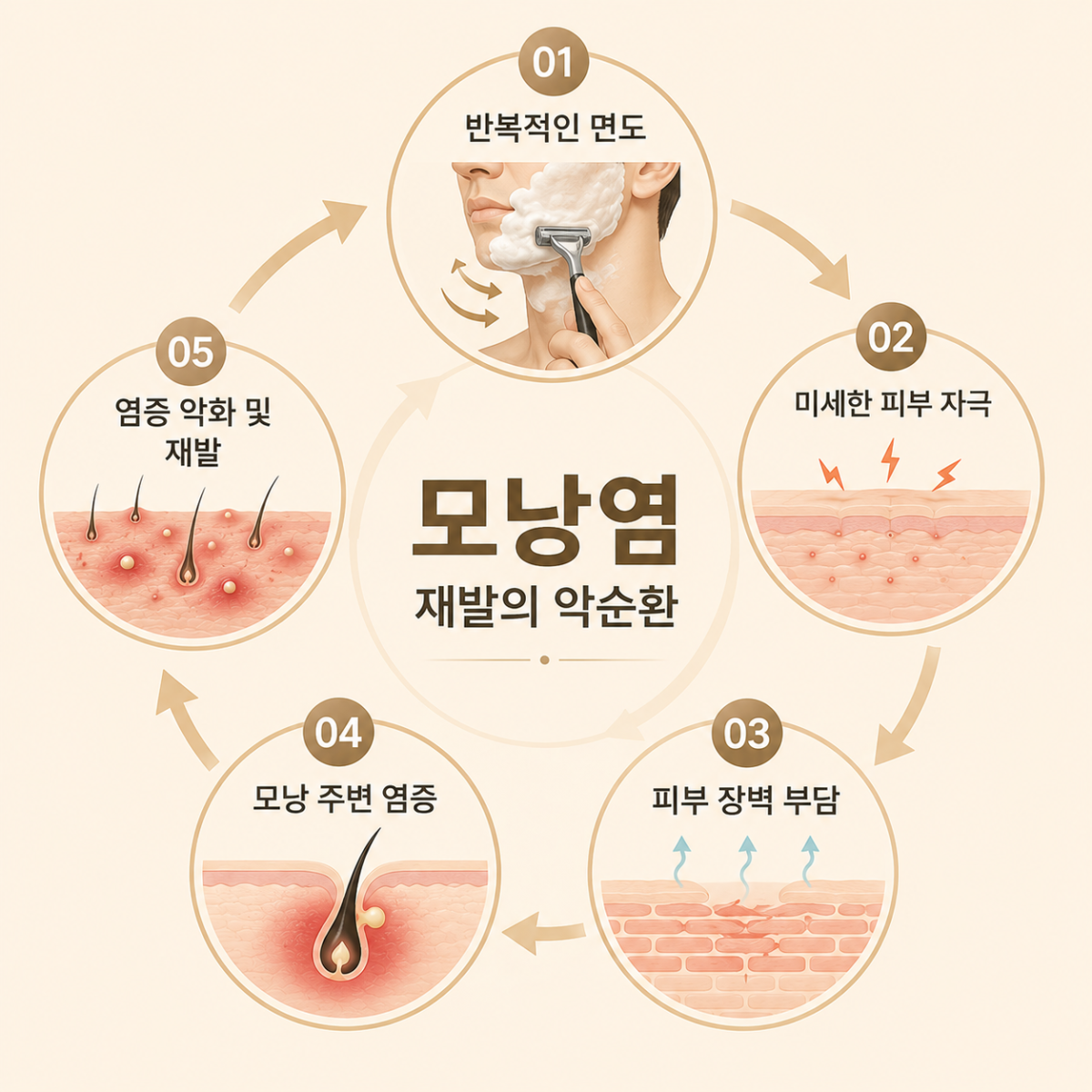 [목동점] 목동모낭염 재발한다면 확인해야 할 것들 - 해율한의원