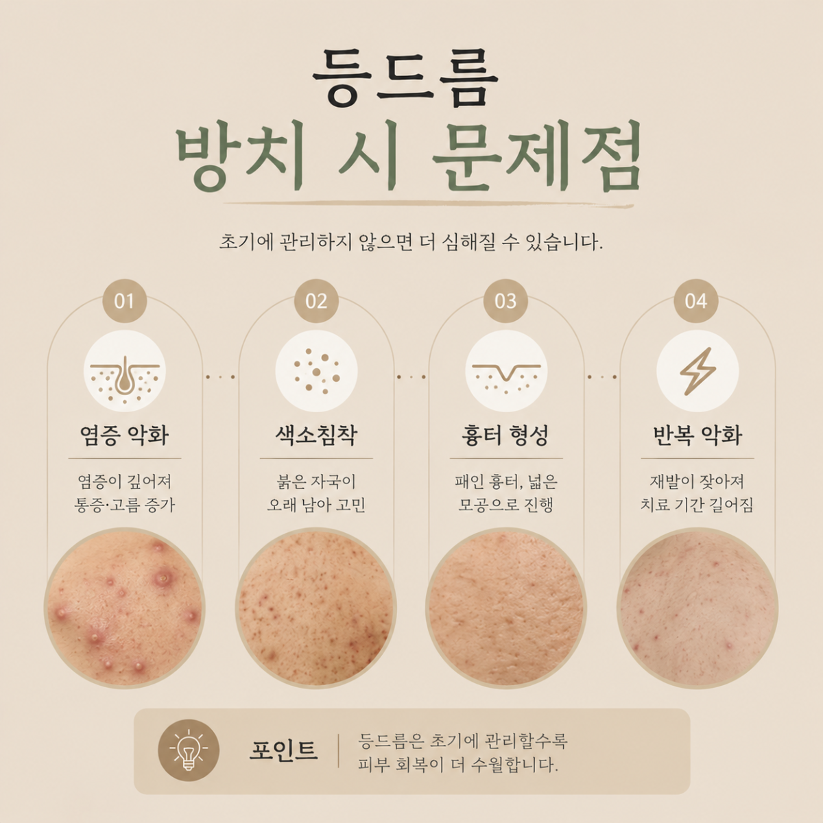 [안산점] 등여드름 등드름 색소침착 미세약초침 치료에 대해 안산 해율한의원이 설명드립니다 - 해율한의원