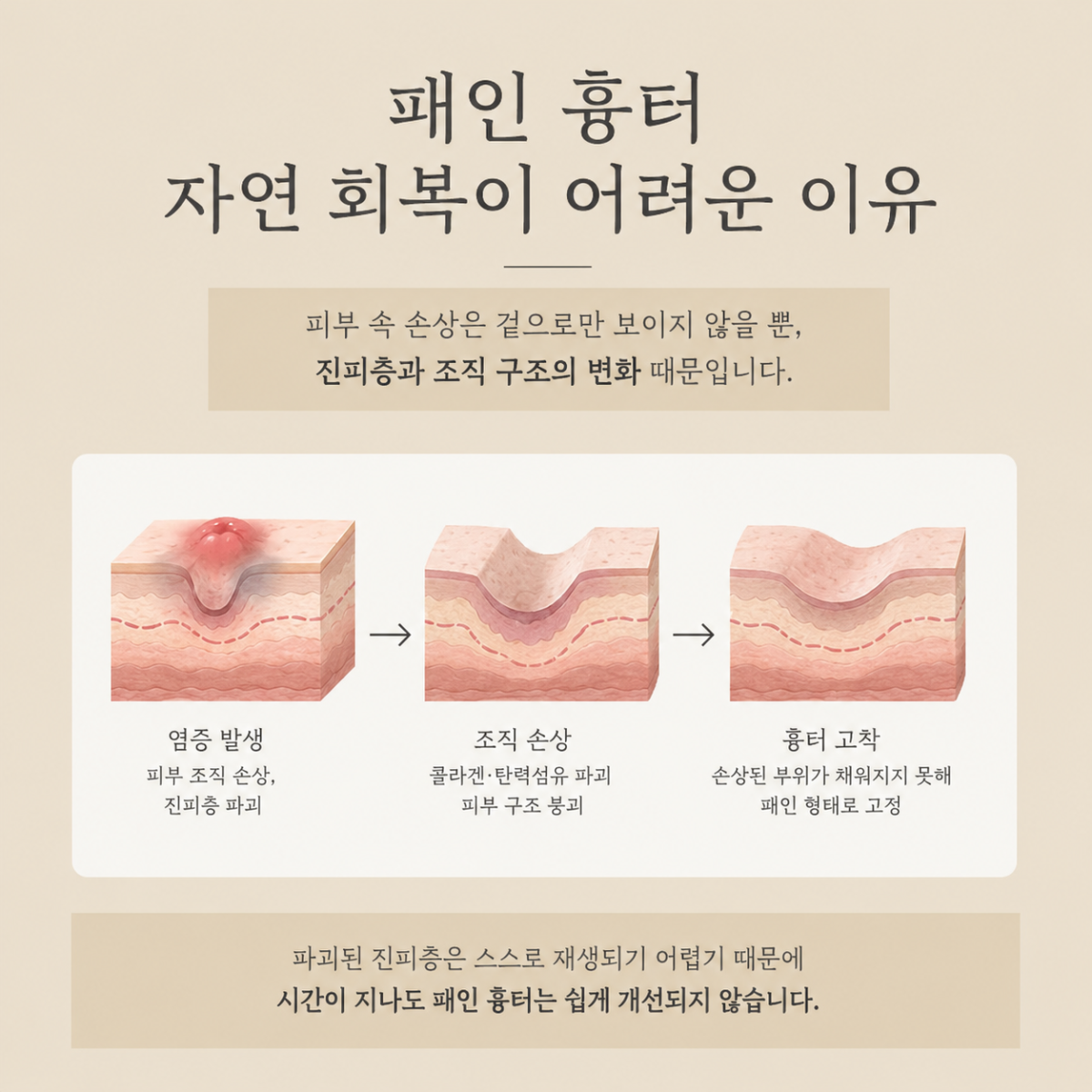 [울산점] 울산새살침 흉터 치료, 서브시전과 어떤 차이가 있을까요? - 해율한의원