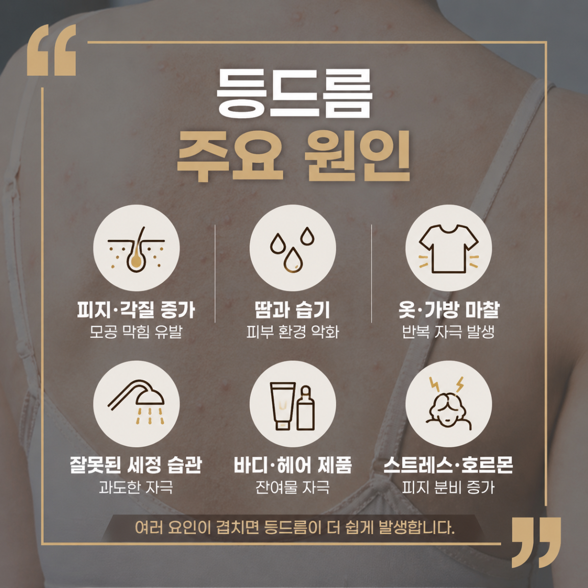 [울산점] 울산등여드름 갑자기 늘었다면 확인해볼 것들 - 해율한의원