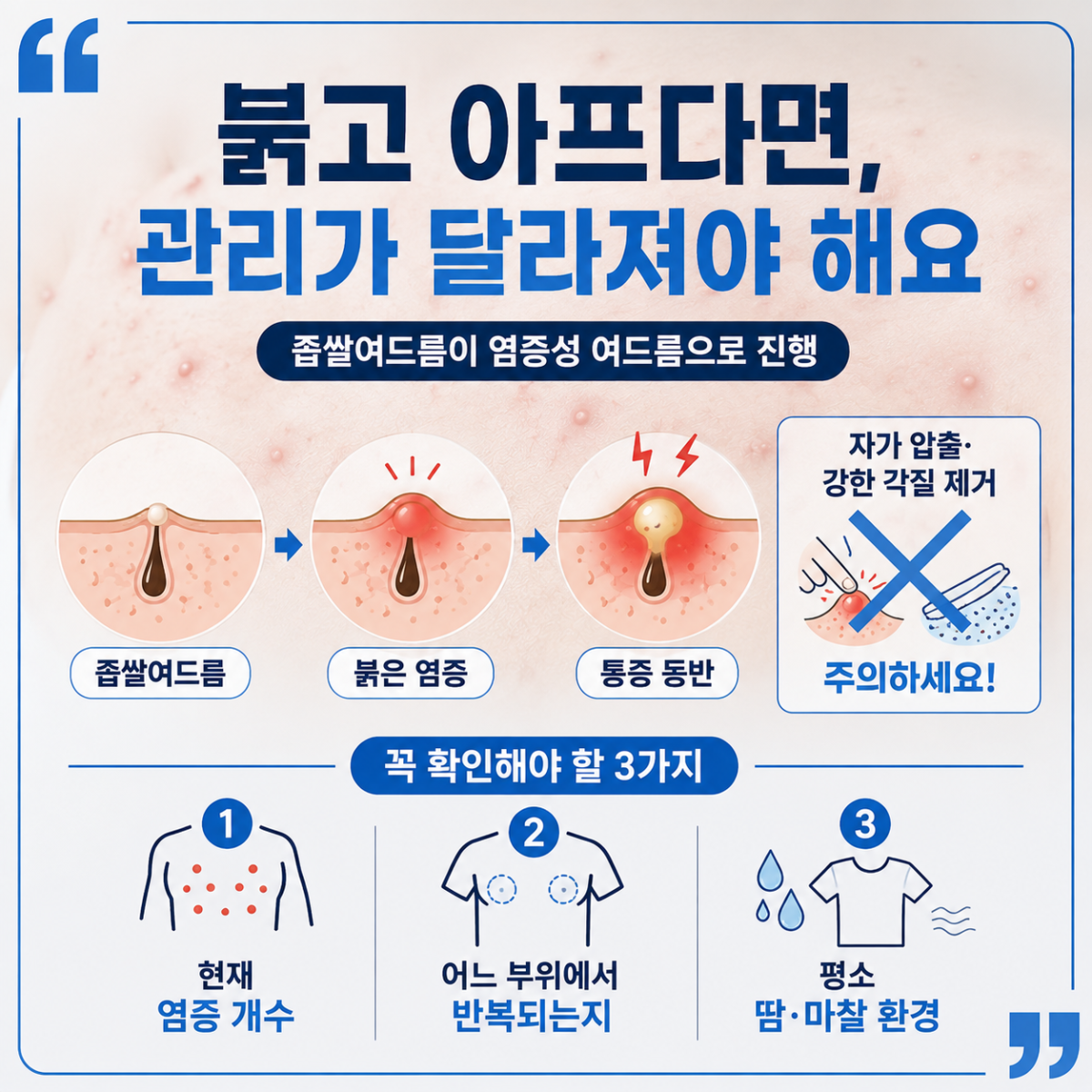 [강남점] 강남가슴여드름 생기는 순간부터 달라져야 할 관리법 - 해율한의원